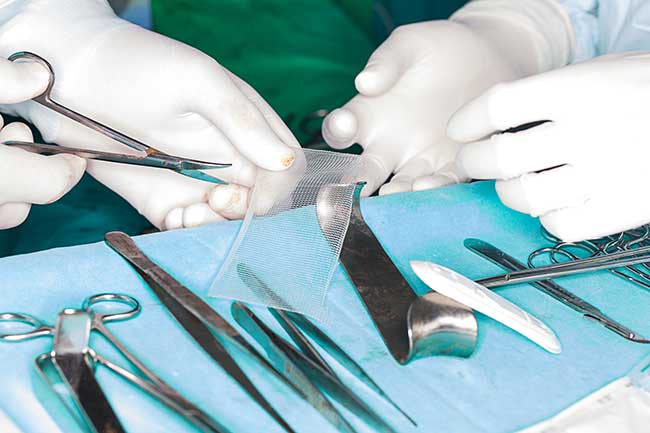 Hernia Surgery